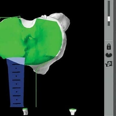 in-the-operating-thatre