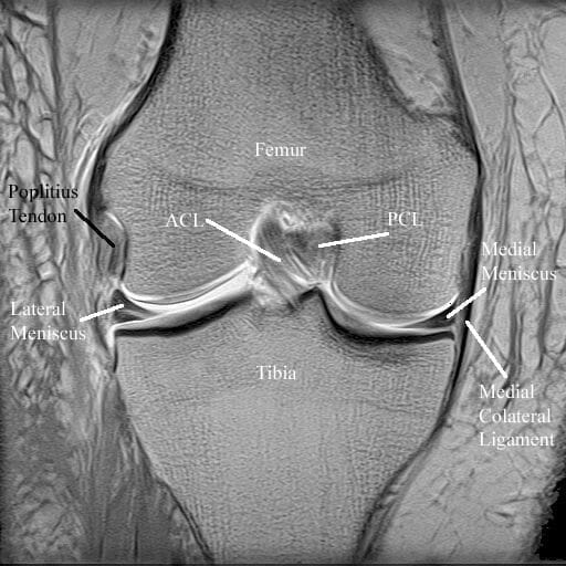 knee-surgery-mri-3